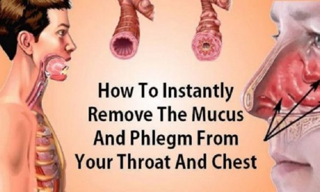 Remember This How To Eliminate Mucus And Phlegm From Your Throat And Chest Instant Result